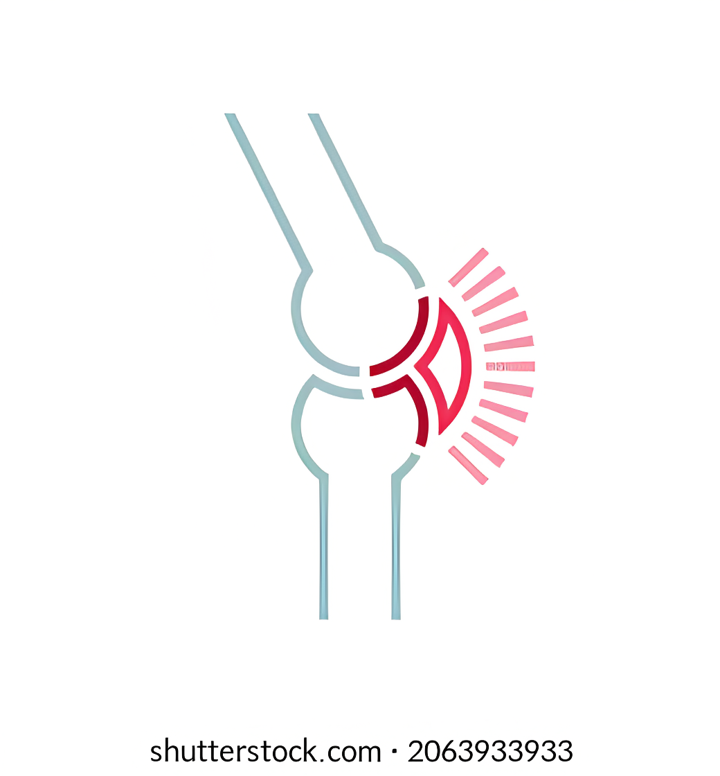 رسم توضيحي للمفاصل